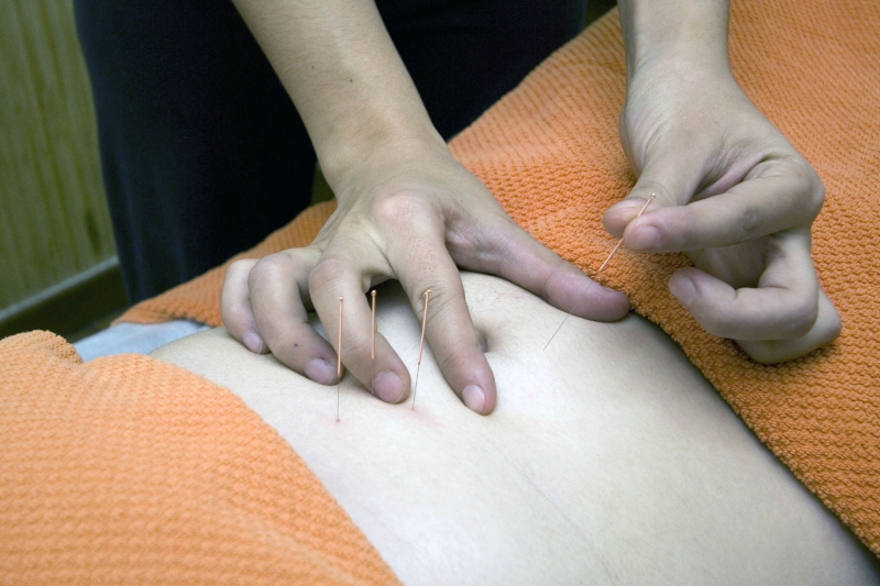 osteopathe-GINASSERVIS-min_acupuncture-4175625